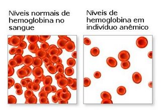 Anemia ferropriva